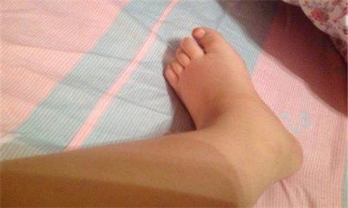 孕妇脚肿穿的鞋子