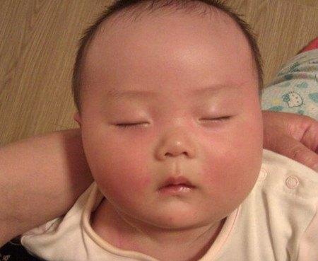 幼儿急疹的护理方法