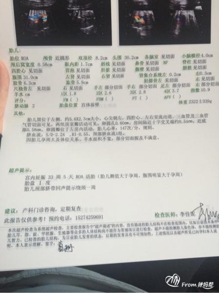 妊娠期糖尿病筛查一定要做吗