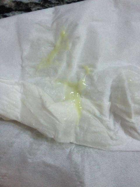 怀孕以后身体有异味怎么回事