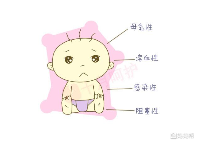 母乳性黄疸怎么回事