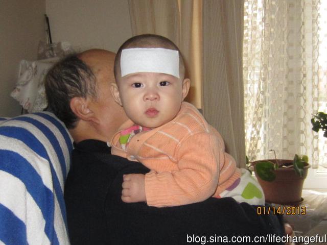 婴儿玫瑰疹不能吃什么