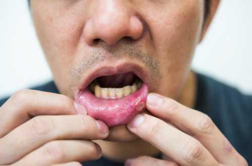 宝宝上火容易引起的疾病