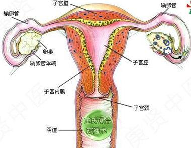 输卵管堵塞有没有明确的症状