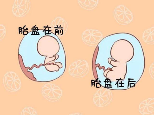 胎盘太厚是什么原因