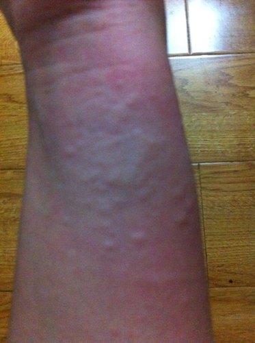 为什么挠自己不痒别人挠就痒