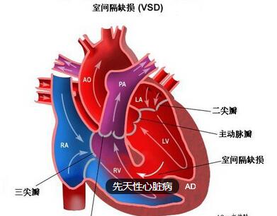 孕检可以检查先天性心脏病吗