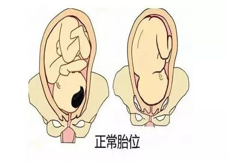 臀位多散步能转头位吗31周