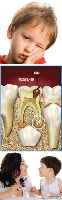 宝宝蛀牙怎么办