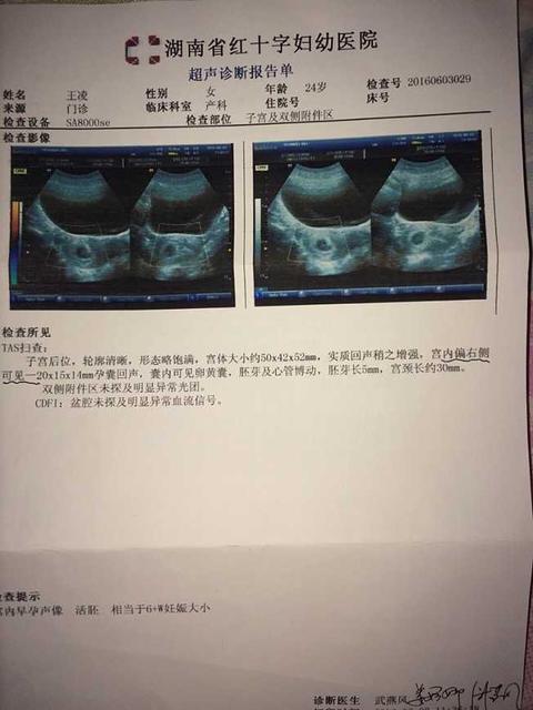 怀孕6周b超能看到孕囊吗