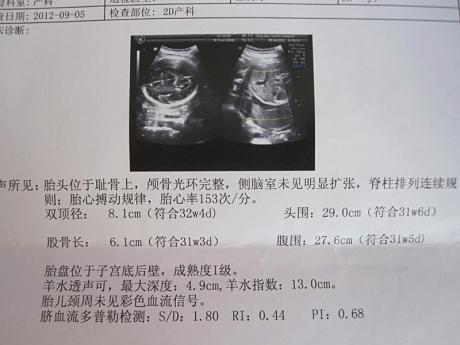 35岁以上孕妇必须做的产检