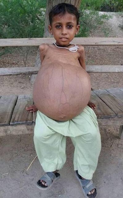 十月怀胎要做哪些检查