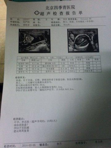 大排畸没检查出来胎儿畸形