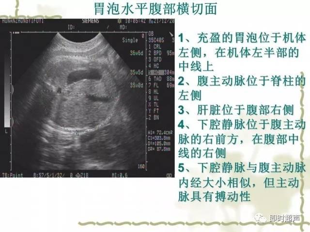 孕期只做一次超声波检查够吗