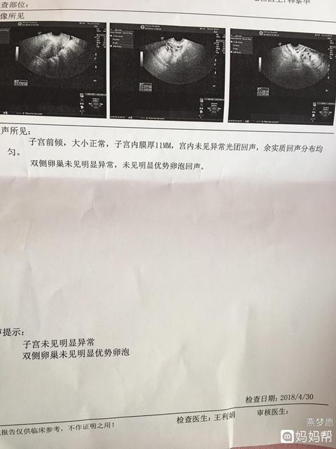 小卵泡排卵能怀孕吗