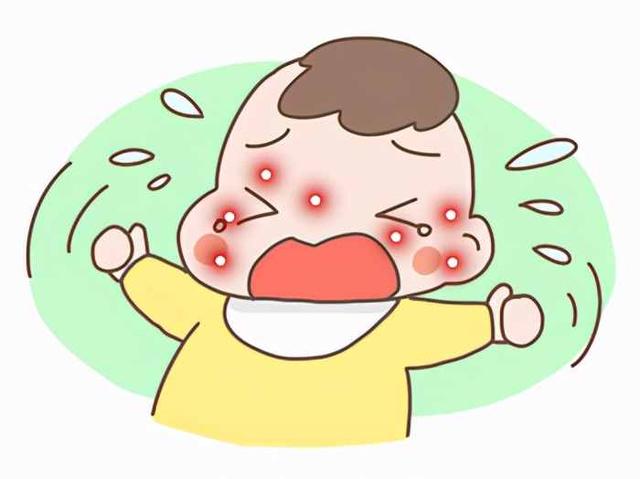 宝宝起湿疹用什么药好一点