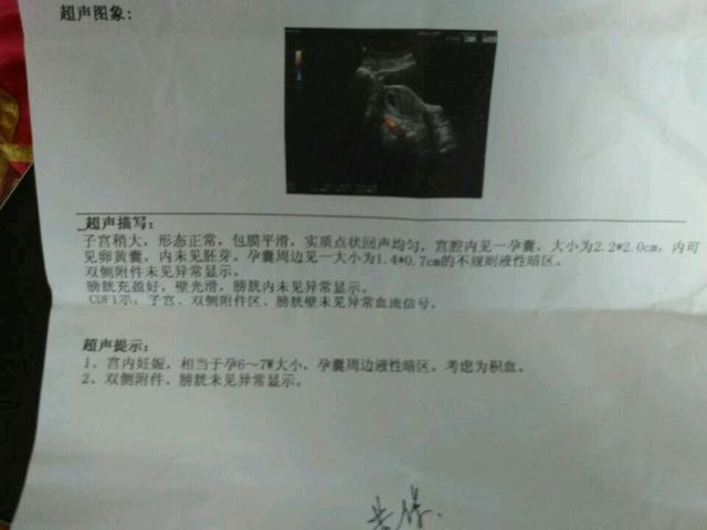 出现胎停有什么症状或征兆吗