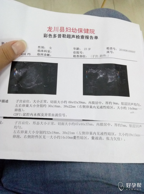 10个小卵泡算多囊吗