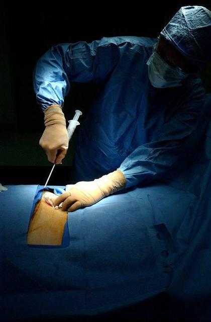 女人剖腹产以后要注意什么