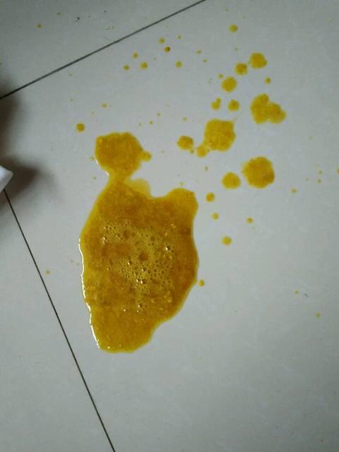 婴儿吃乳糖酶的好处