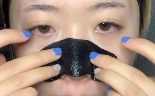 每次去黑头都超级解压哈哈!