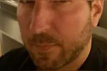 安东尼&middot;塔姆巴基斯