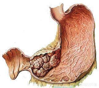 怀孕了在饮食上注意什么