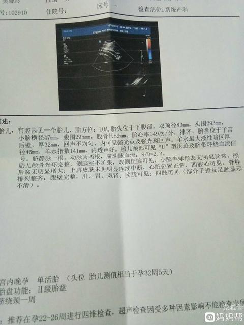 男宝宝要比女宝宝提前生吗