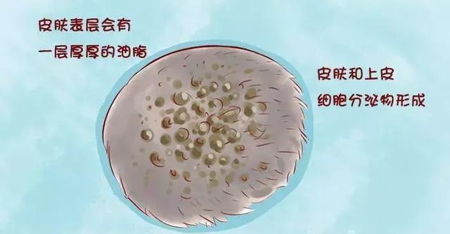 宝宝乳痂多了怎么办