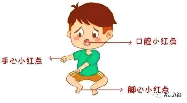 秋冬季怎么预防宝宝感冒