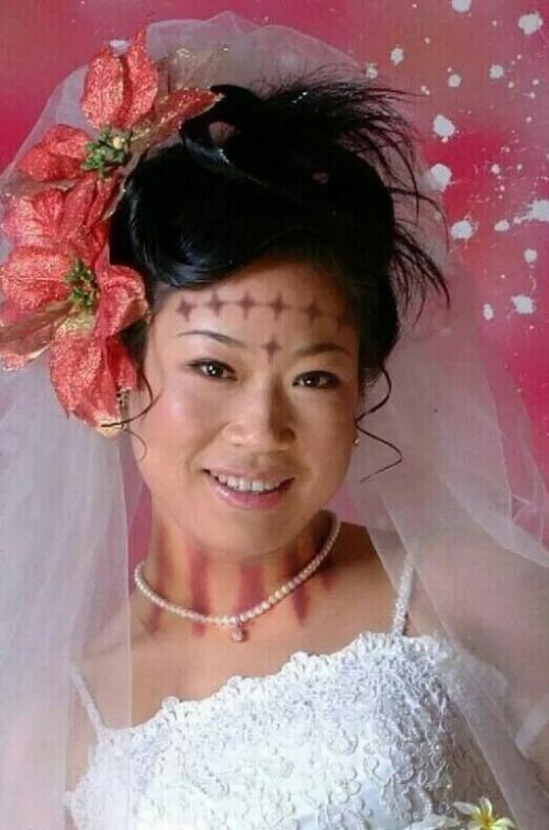 爱痧揪痧确实给我的人生带来了无尽的欢乐和精彩春光无限美好