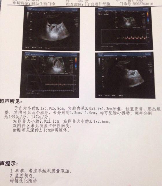 怎样判断人流是否干净