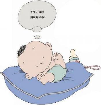 宝宝腿纹不对称一定有问题吗?