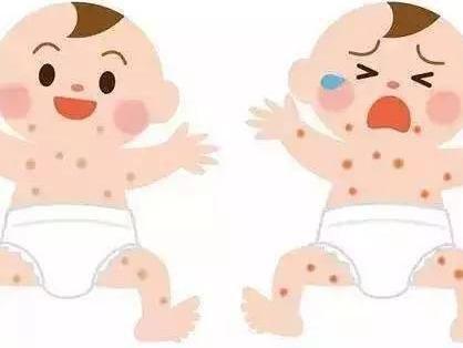 婴儿出玫瑰疹怎么办