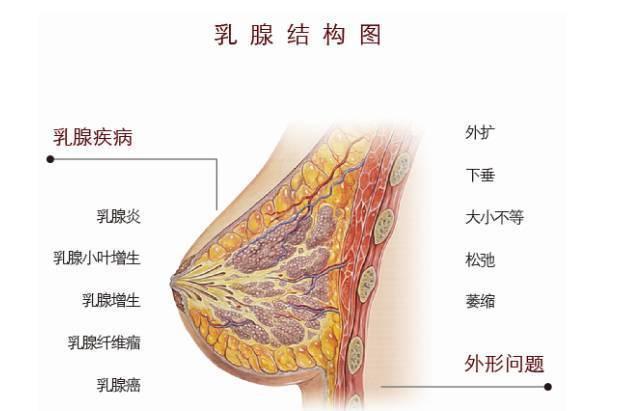 预防乳腺癌应该怎么做