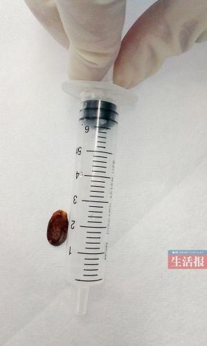 一岁的宝宝可以吃瓜子吗?