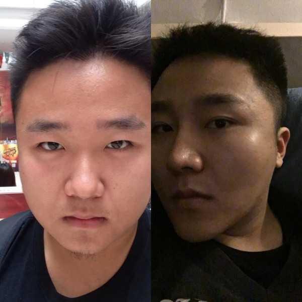 男生割双眼皮是种什么想法呢