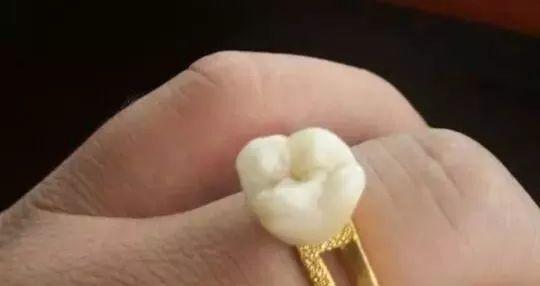 坐月子其实可以刷牙