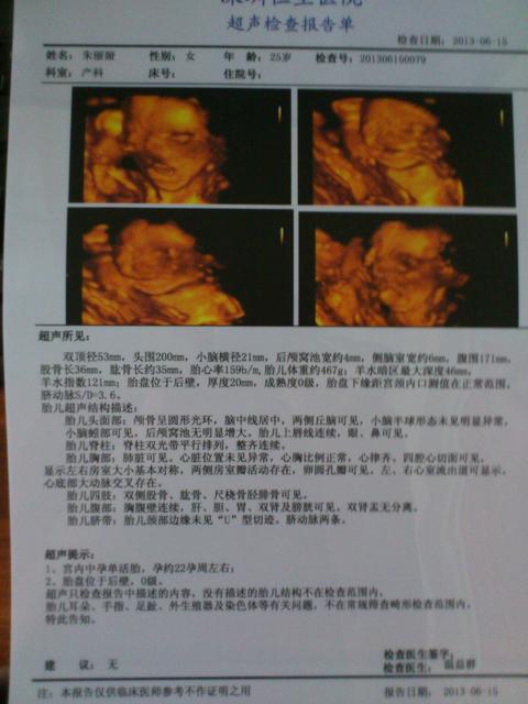 四维彩超多少钱啊