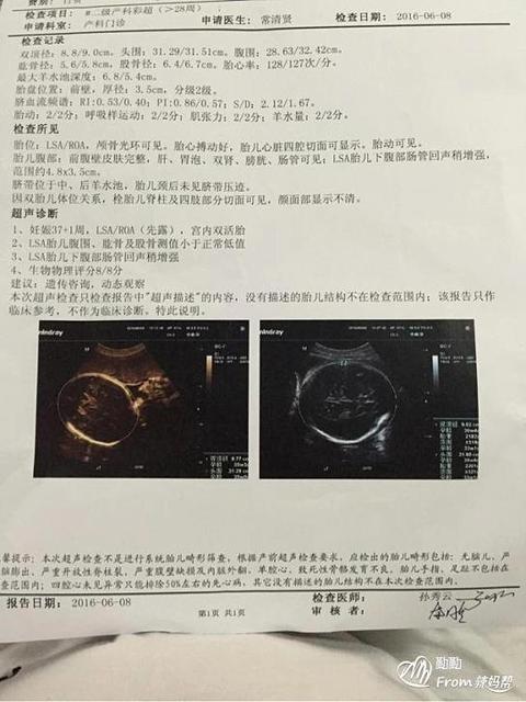 双绒双羊宝宝不是一样大有关系吗