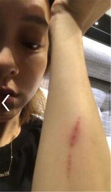 孩子摔倒后怎么判断有没有事