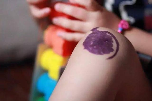 孩子皮肤容易过敏怎么办