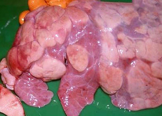 如何预防小儿肺炎的发生