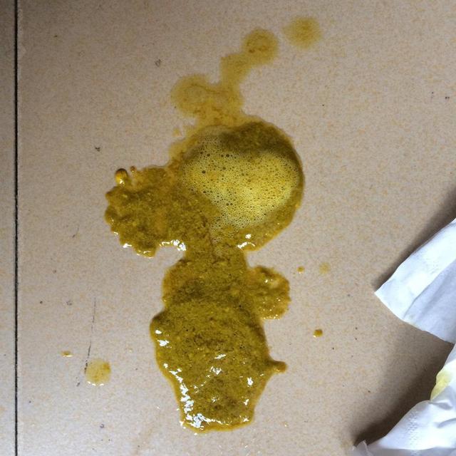 新生儿宝宝一天排便多少次