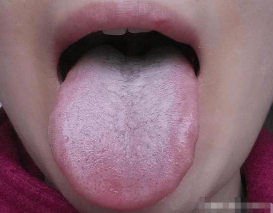 宝宝脾胃不好有哪些症状表现