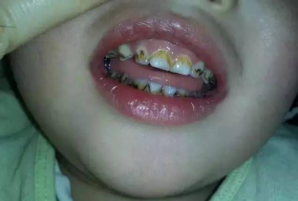 5岁以下儿童喝什么最好