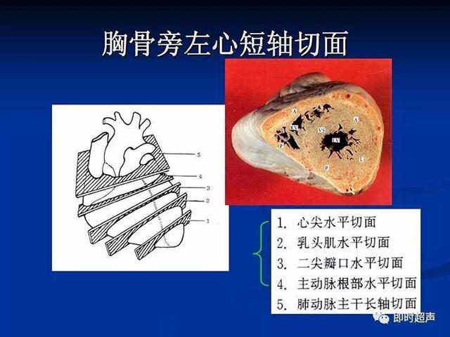 产科超声检查分哪几种