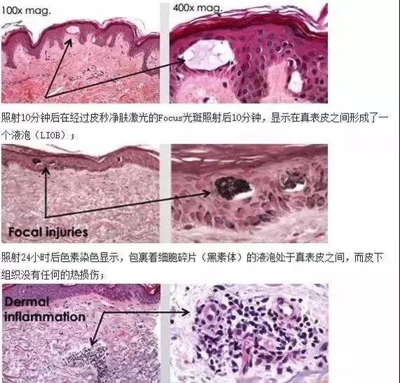 怎么判断宝宝是否对食物过敏