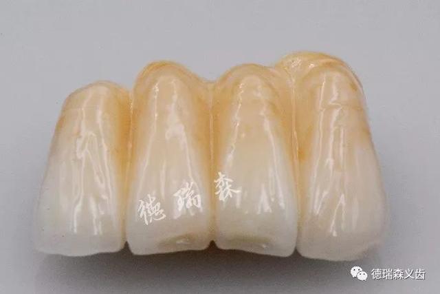 婴儿牙齿变色怎么办
