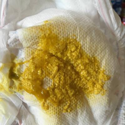 宝宝腹泻怎么办?